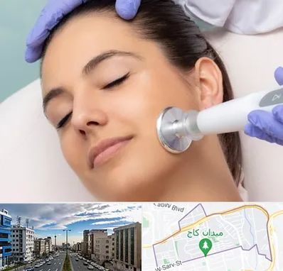 پلاسما جت در سعادت آباد تهران