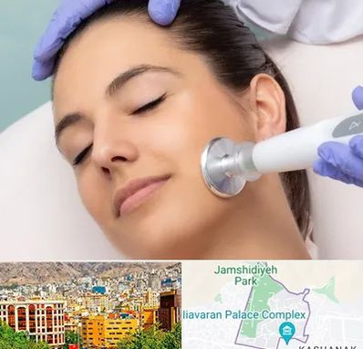 پلاسما جت در نیاوران