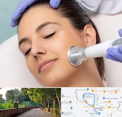 پلاسما جت در فلکه گاز رشت