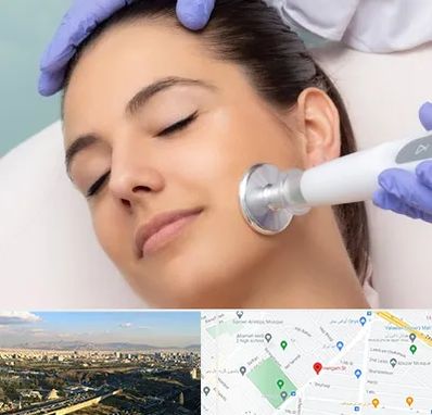 پلاسما جت در هنگام