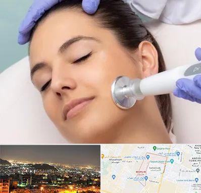 پلاسما جت در مارلیک کرج