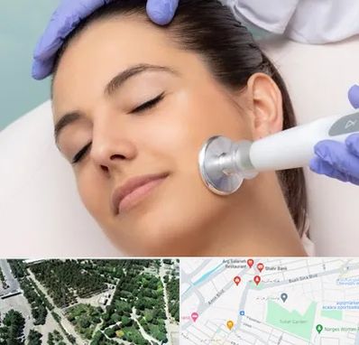 پلاسما جت در سالاریه قم