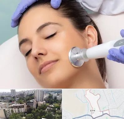 پلاسما جت در اوین