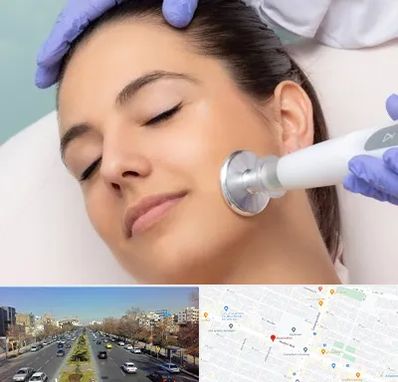 پلاسما جت در بلوار معلم مشهد