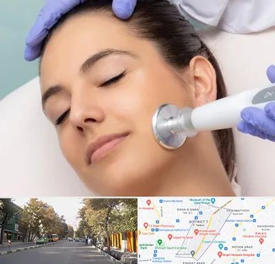 پلاسما جت در شریعتی