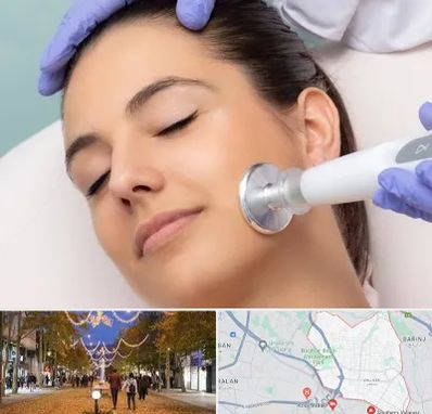 پلاسما جت در ولیعصر ارومیه