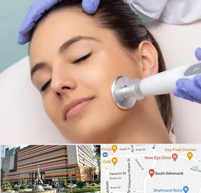 پلاسما جت در سهروردی