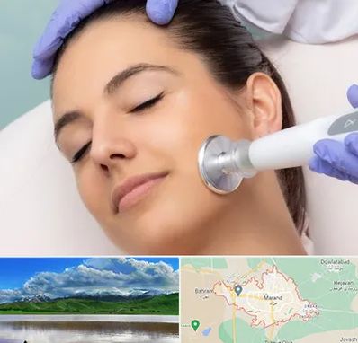 پلاسما جت در مرند