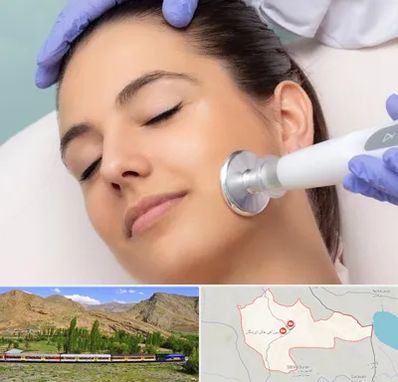 پلاسما جت در خاش