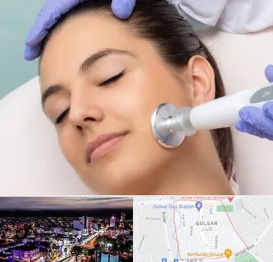 پلاسما جت در گلسار رشت