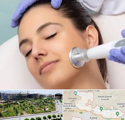 پلاسما جت در پردیس