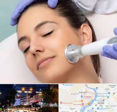 پلاسما جت در کیانپارس اهواز