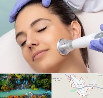 پلاسما جت در دورود