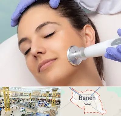 پلاسما جت در بانه