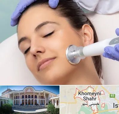 پلاسما جت در خمینی شهر