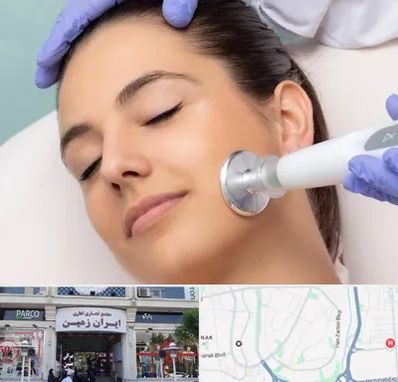 پلاسما جت در ایران زمین