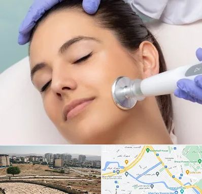 پلاسما جت در کوی وحدت شیراز