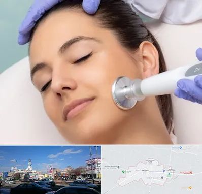 پلاسما جت در ماهدشت کرج