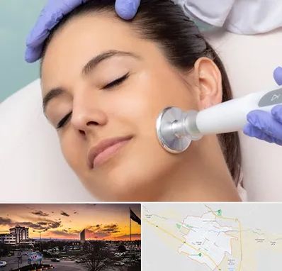 پلاسما جت در قوچان