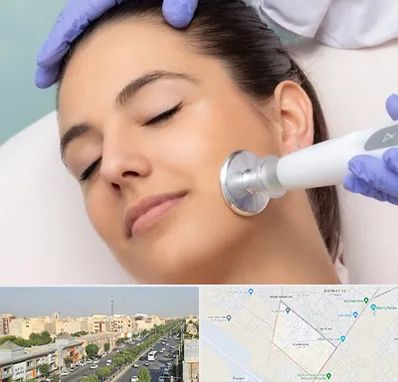 پلاسما جت در کیانمهر کرج