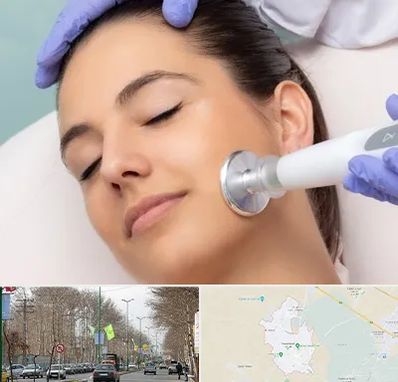 پلاسما جت در نظرآباد کرج