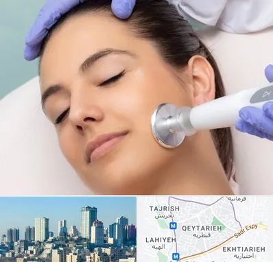 پلاسما جت در قیطریه