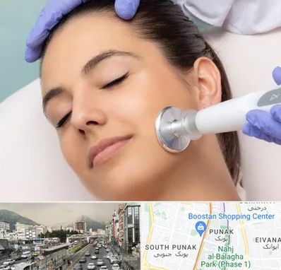 پلاسما جت در پونک