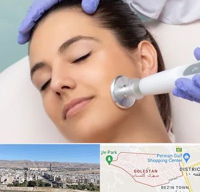 پلاسما جت در شهرک گلستان شیراز