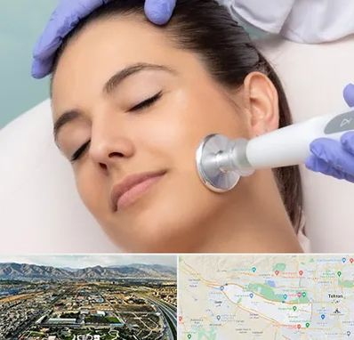 پلاسما جت در منطقه 21 تهران