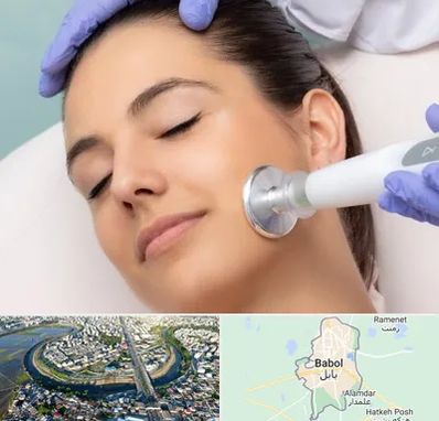 پلاسما جت در بابل