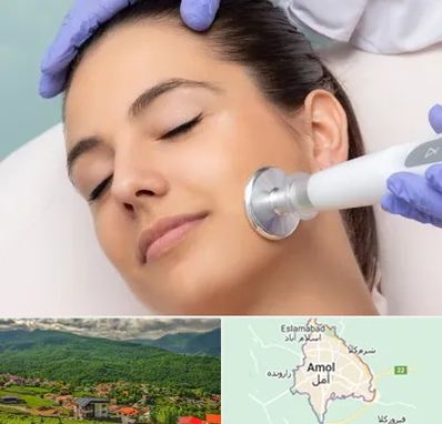 پلاسما جت در آمل