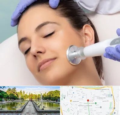 پلاسما جت در سرسبز