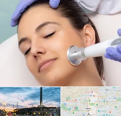 پلاسما جت در منطقه 2 تهران