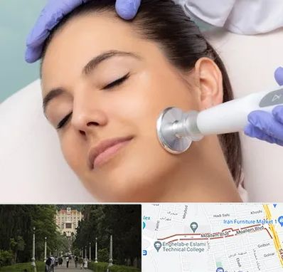 پلاسما جت در بلوار معلم رشت