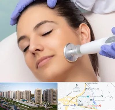 پلاسما جت در المپیک