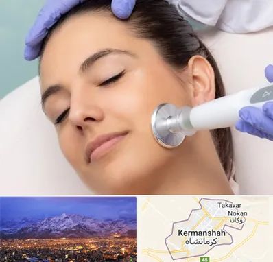 پلاسما جت در کرمانشاه