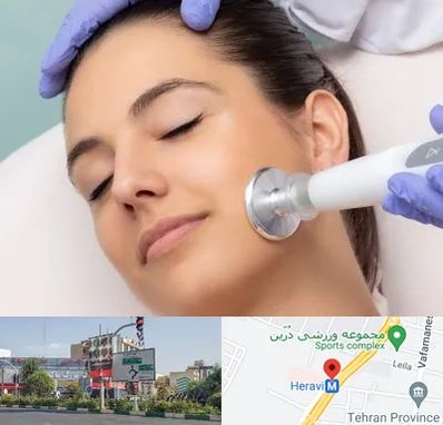 پلاسما جت در هروی