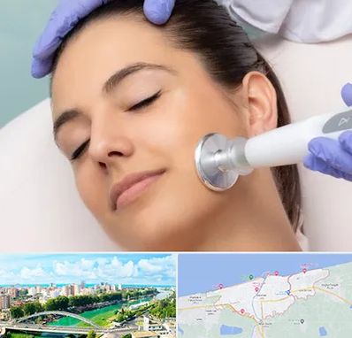 پلاسما جت در بابلسر