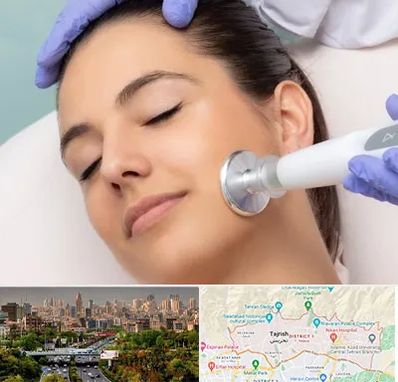 پلاسما جت در منطقه 1 تهران