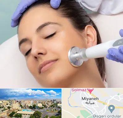 پلاسما جت در میانه