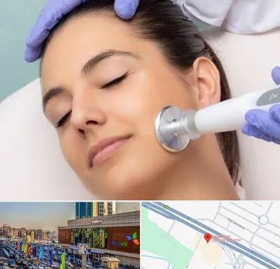 پلاسما جت در لاله پارک تبریز