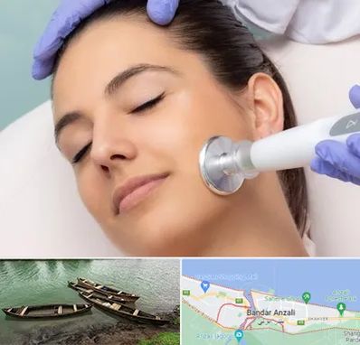 پلاسما جت در بندر انزلی