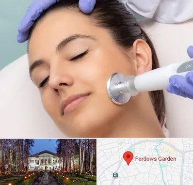 پلاسما جت در باغ فردوس