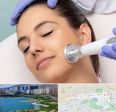 پلاسما جت در منطقه 22 تهران