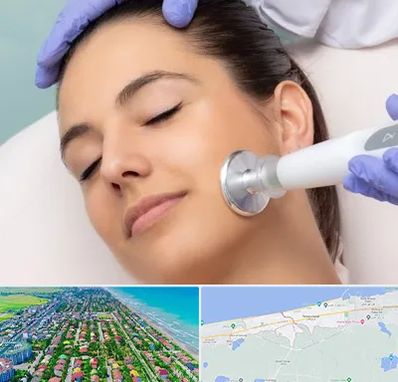 پلاسما جت در فریدونکنار