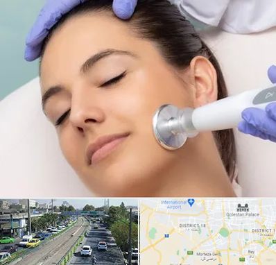 پلاسما جت در جنوب تهران