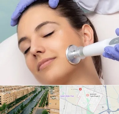 پلاسما جت در فاز سه اندیشه