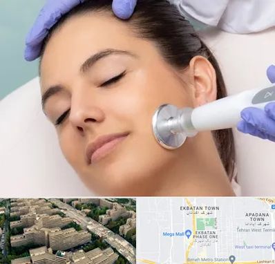 پلاسما جت در اکباتان