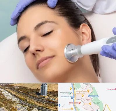 پلاسما جت در خیابان نیایش شیراز