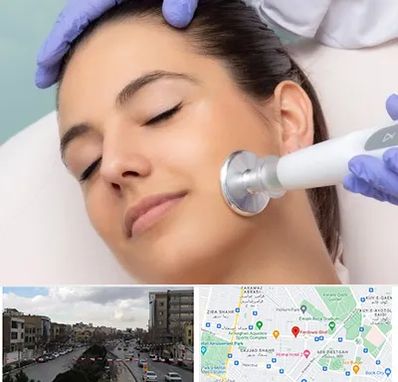 پلاسما جت در بلوار فردوسی مشهد